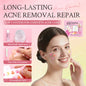 Beauty Host Acne Removal Repair 4-in-1 System main image