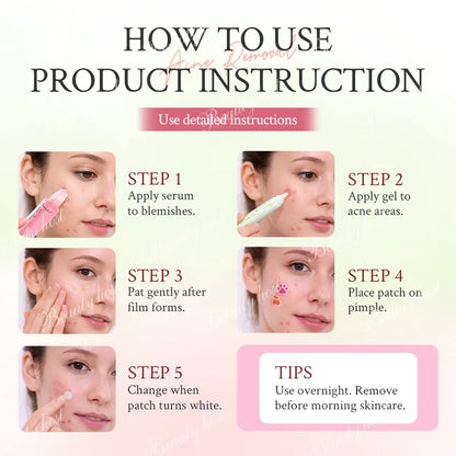 Beauty Host Acne Removal Repair how to use